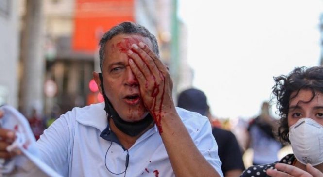 Governo de Pernambuco vai indenizar feridos da violência policial no protesto de sábado