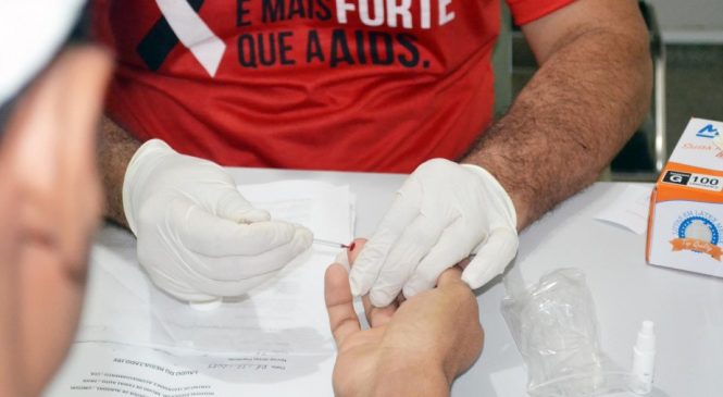 Após pandemia, casos graves de Aids têm chegado com frequência ao hospital Helvio Auto