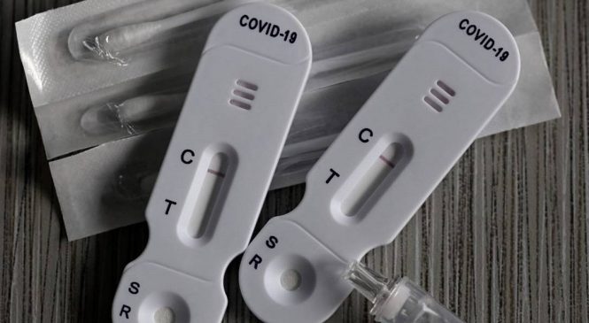 Anvisa aprova uso e comercialização de autoteste para covid-19