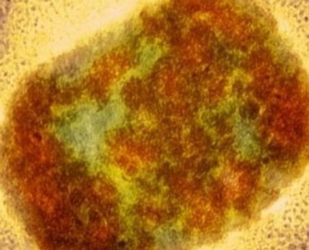 Com 6 casos suspeitos de varíola dos macacos, Ministério da Saúde se põe em alerta