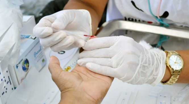 Hospital Helvio Auto registra aumento de 31% em casos de HIV/Aids em 2023