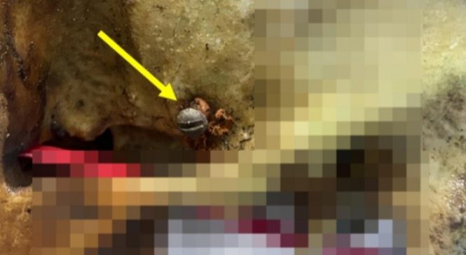Polícia Científica conclui exames no crânio encontrado de Mar Vermelho