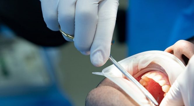 Saúde bucal: Saiba as principais causas de perda de dentes na população adulta